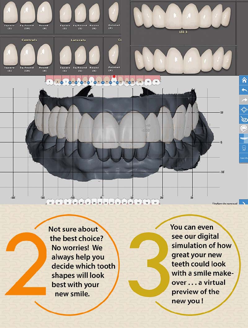 Digital smile designer steps 2 and 3: choose tooth shapes and see the digital simulation