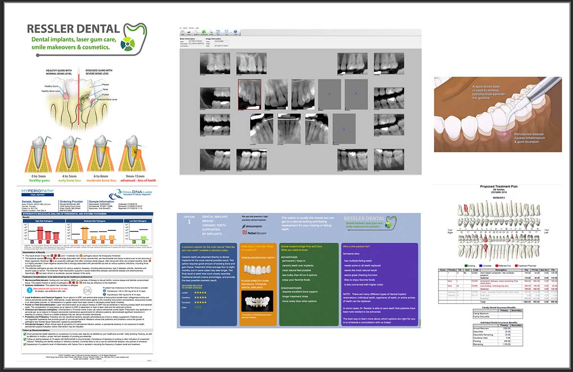 Sample Ressler Dental take-home treatment plan with itemized costs