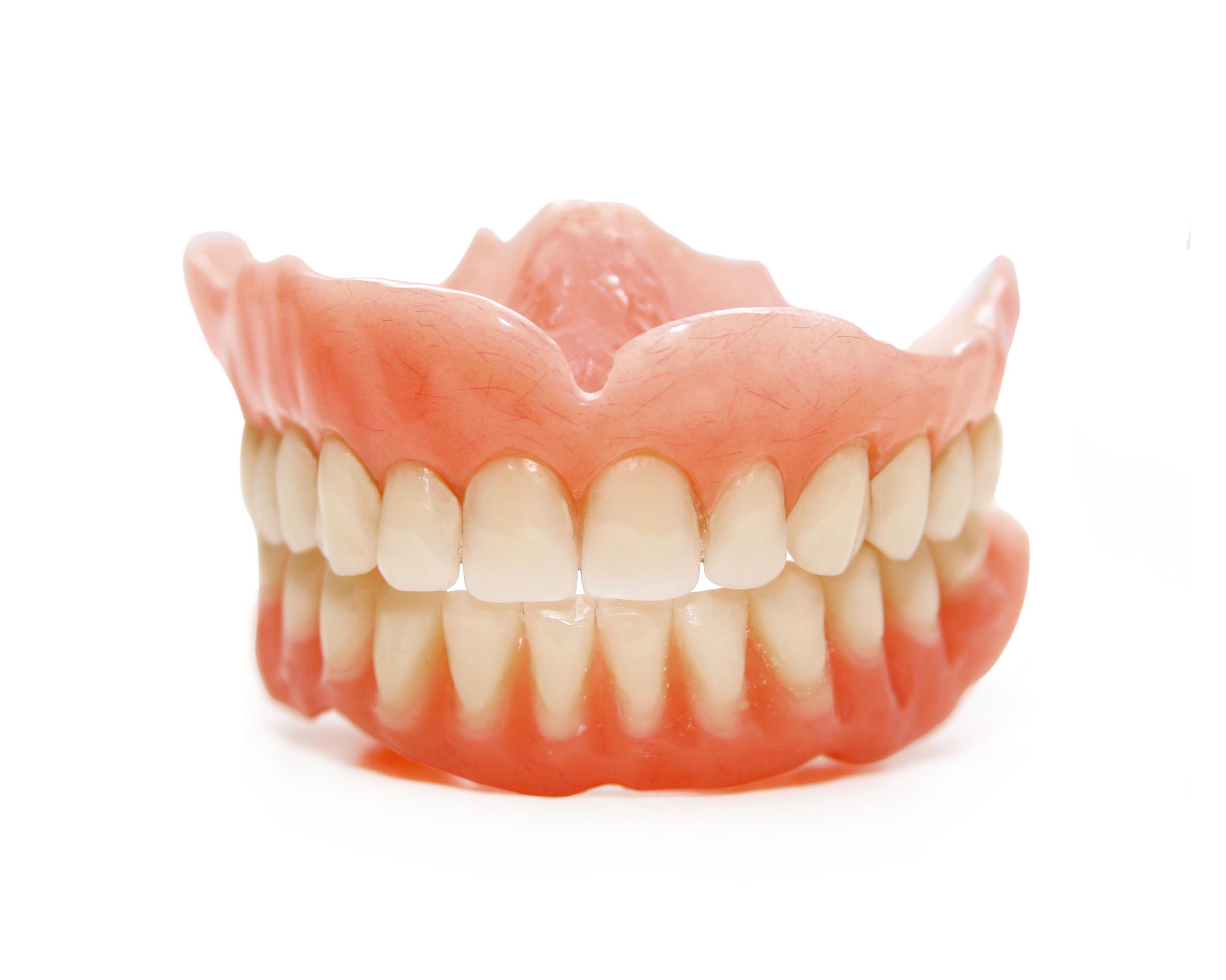 Full removable dentures without implants, secured only by suction and denture adhesive