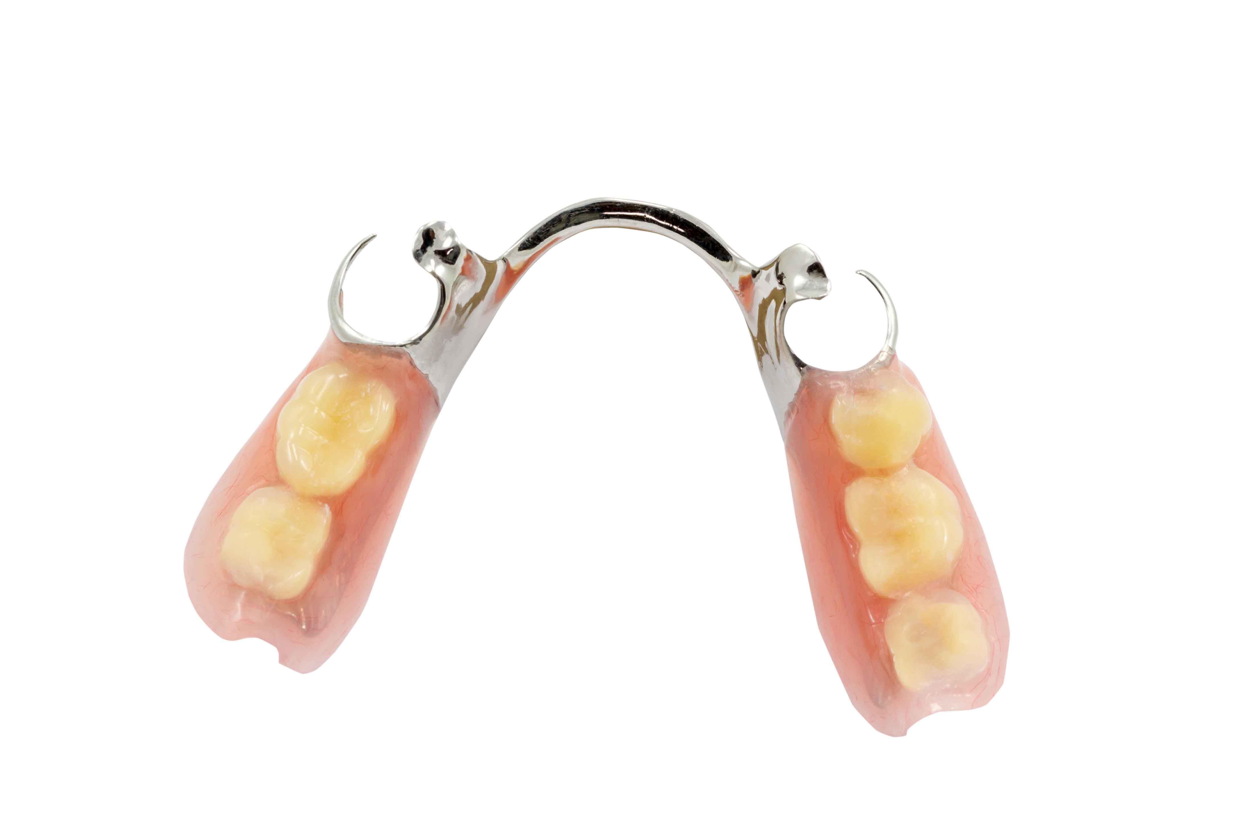 Partial removable denture without implants