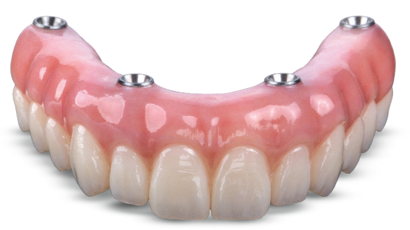 Zirconia ultra-strong ceramic full arch All-on-4 implant teeth